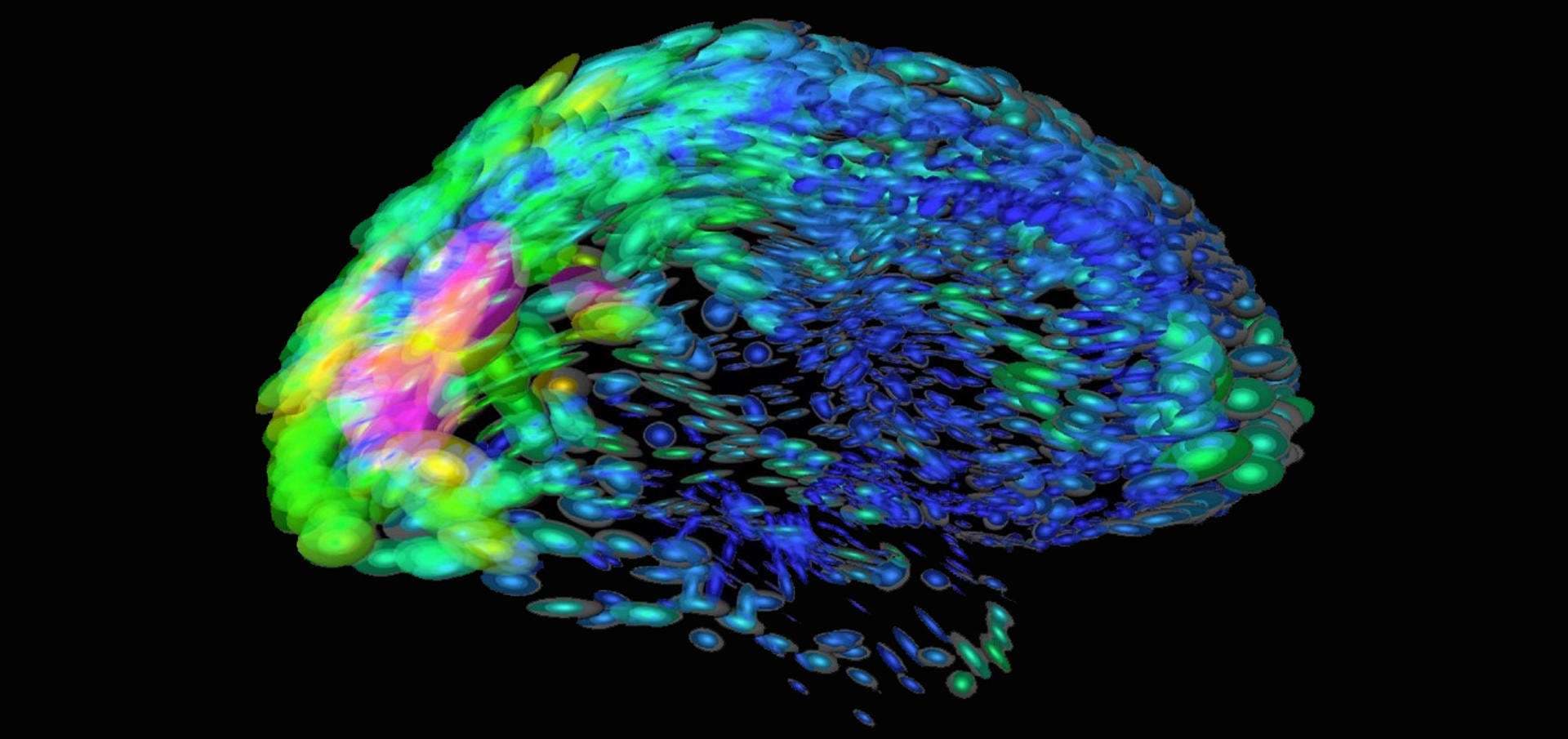 Esto es lo que se ha dado a conocer sobre la supuesta teoría que explica relación entre complejidad cognitiva y la asimetría cerebral.