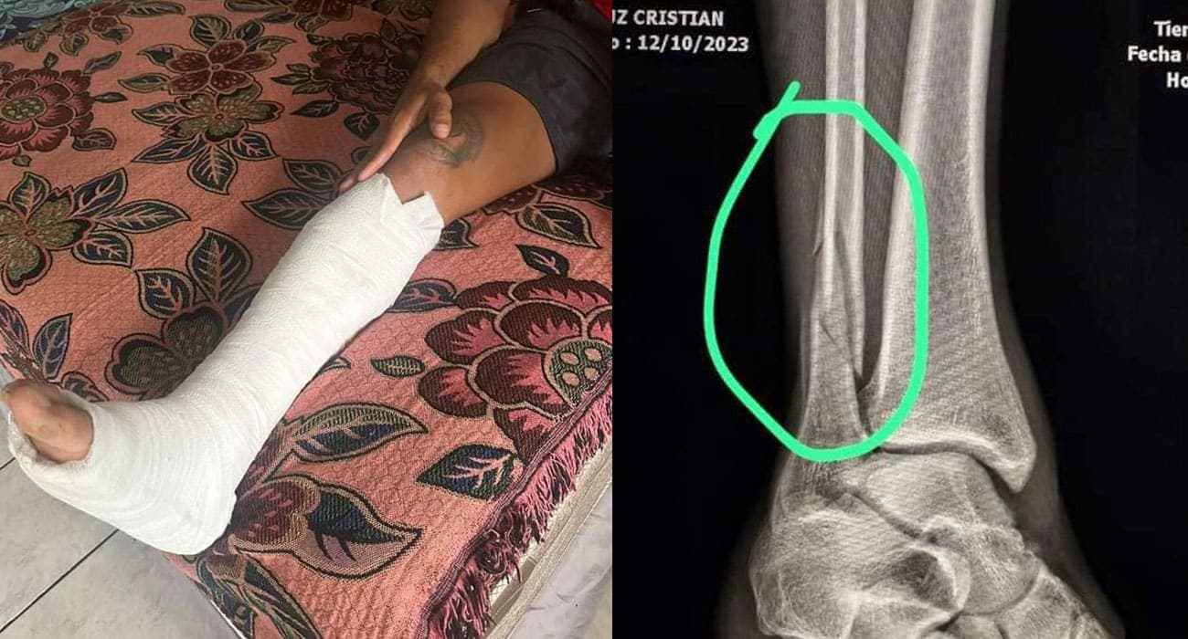 Jugador mundialista en 2011 con dura lesión y será operado