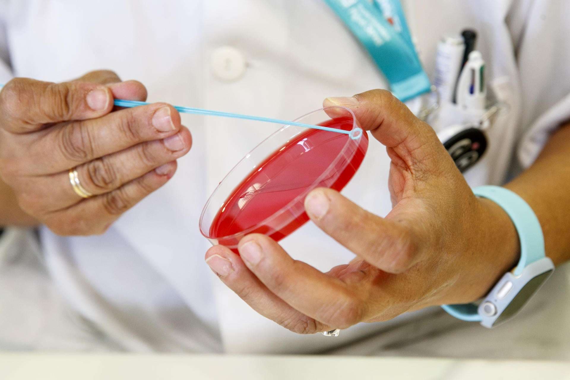 OMS lanza CoViNet, red global para el estudio de los coronavirus