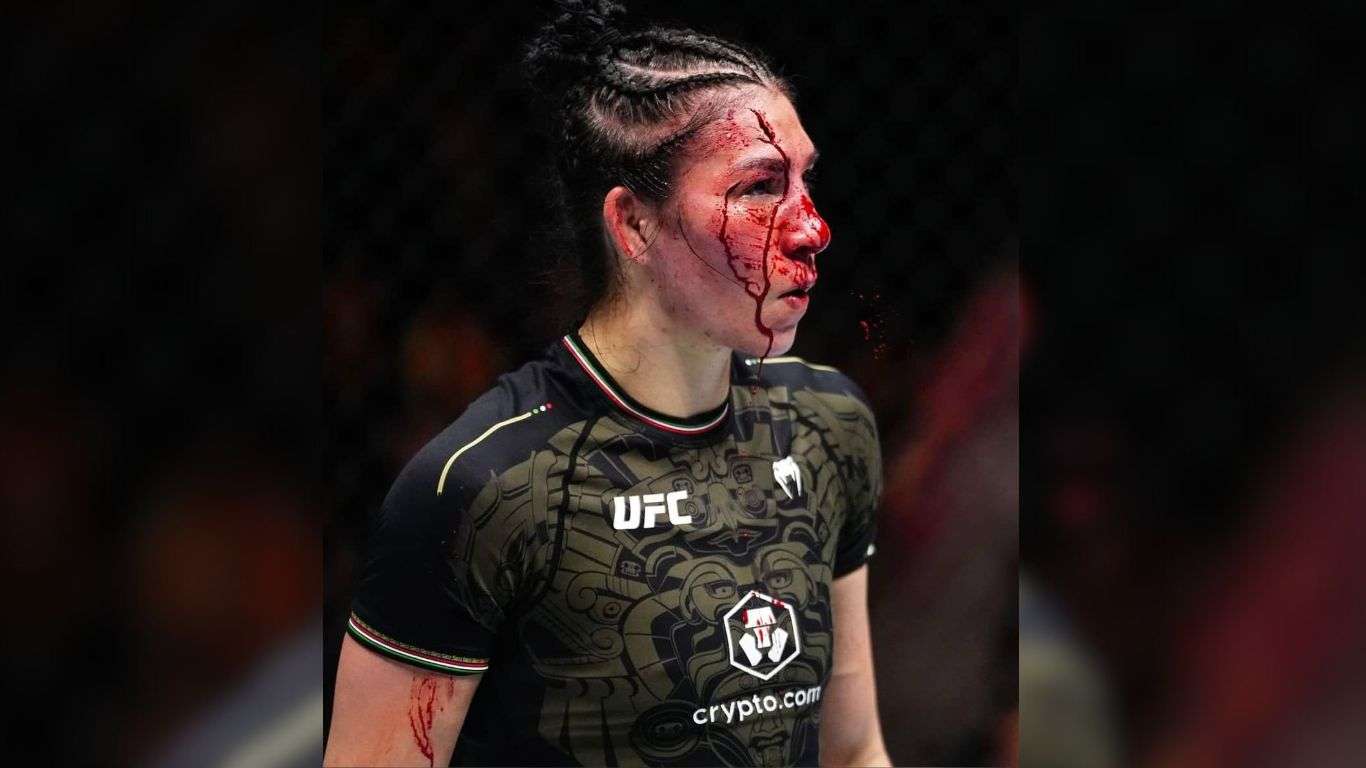 EN IMÁGENES | La impresionante herida que sufrió Irene Aldana en la Noche UFC