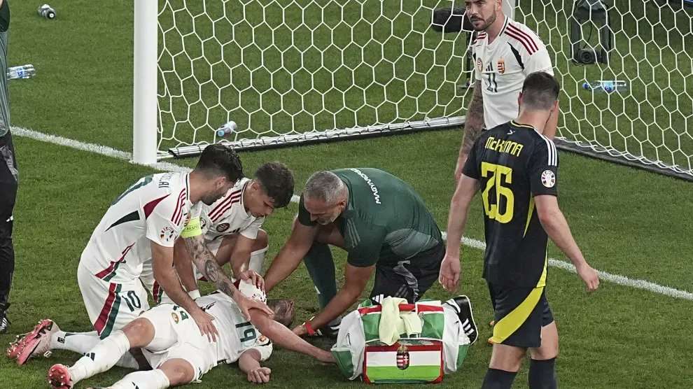 jugador de hungria con huesos rotos en la cara