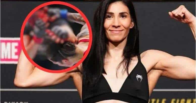 Así quedó el rostro de Irene Aldana tras pelea en la UFC