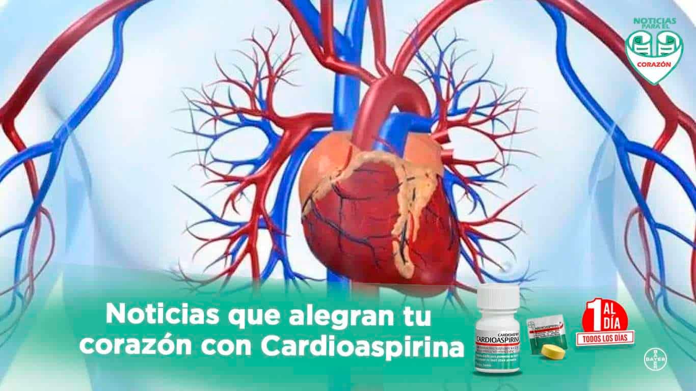 Cardiomegalia